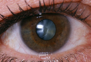 princ rm photo of close up of eye